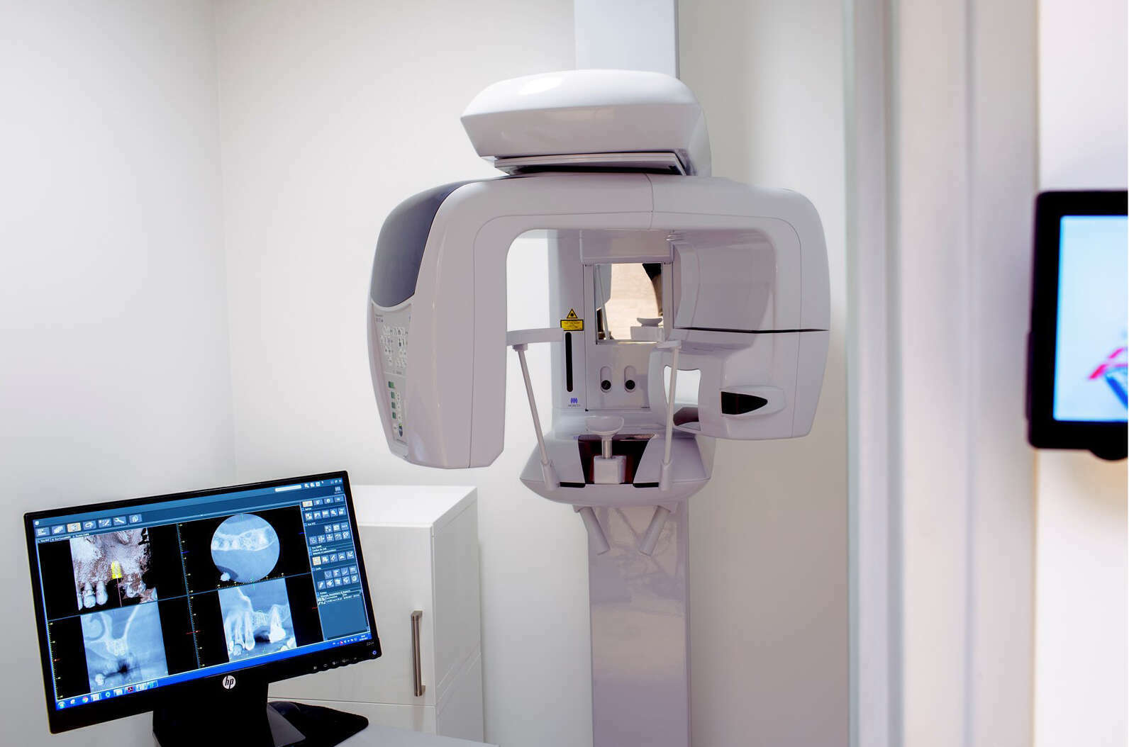 Imagerie 3D Cone Beam